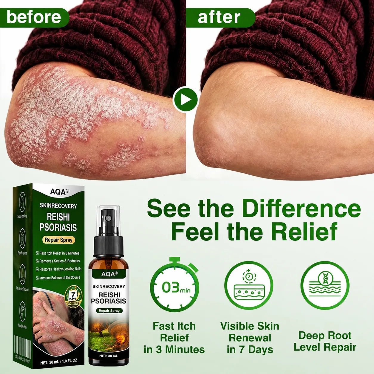 AQA SkinRecovery campaign comparison
