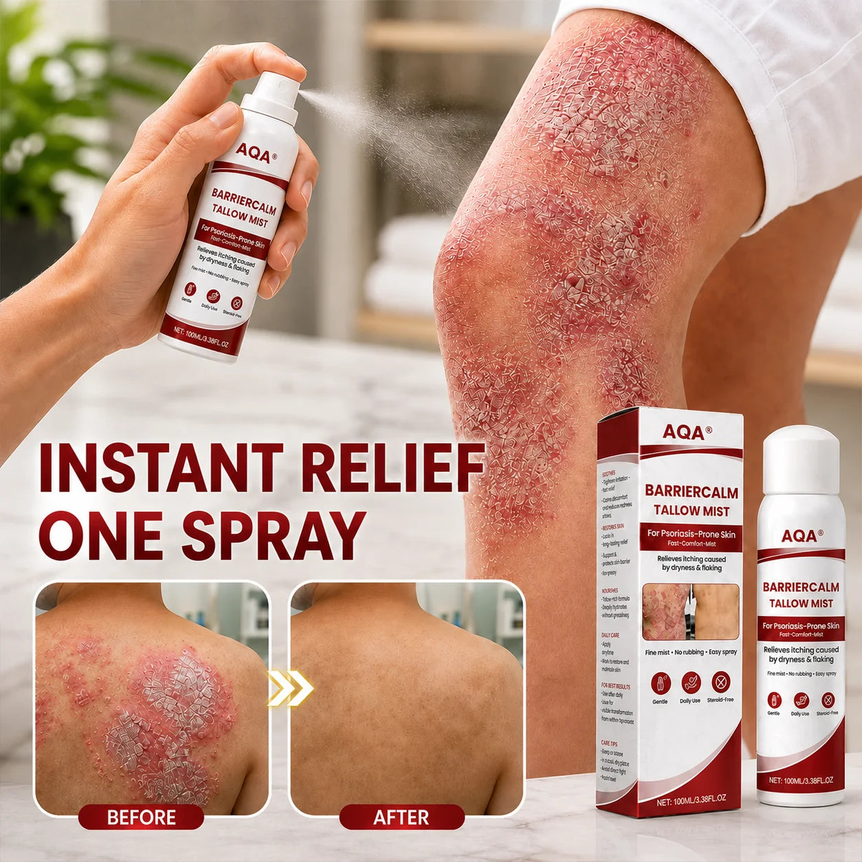 AQA® Beef Tallow Skin Spray – Deep Moisture for Itchy, Flaky, Very Dry & Psoriasis-Prone Skin – Easy Mess-Free Body Moisturizer