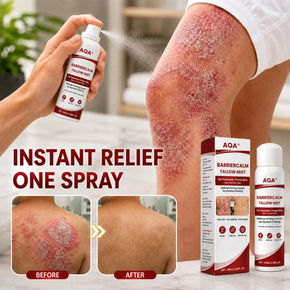 AQA® Beef Tallow Skin Spray – Deep Moisture for Itchy, Flaky, Very Dry & Psoriasis-Prone Skin – Easy Mess-Free Body Moisturizer