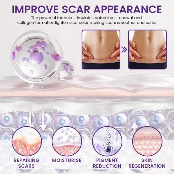 AQA RegenScar scar appearance benefits illustration