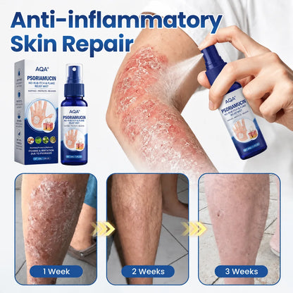 AQA® PsoriaMucin No-Rub Itch & Flake Relief Mist