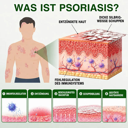 AQA DE Bild 04 – Psoriasis erklärt