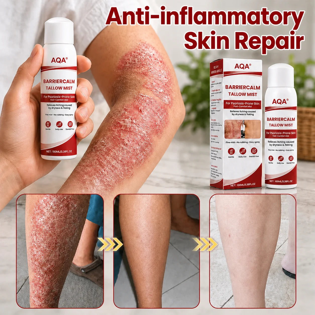 AQA® Beef Tallow Skin Spray – Deep Moisture for Itchy, Flaky, Very Dry & Psoriasis-Prone Skin – Easy Mess-Free Body Moisturizer