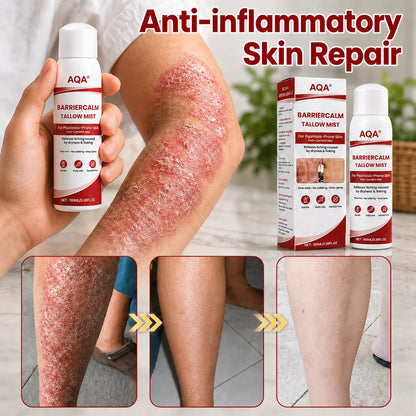 AQA® Beef Tallow Skin Spray – Deep Moisture for Itchy, Flaky, Very Dry & Psoriasis-Prone Skin – Easy Mess-Free Body Moisturizer
