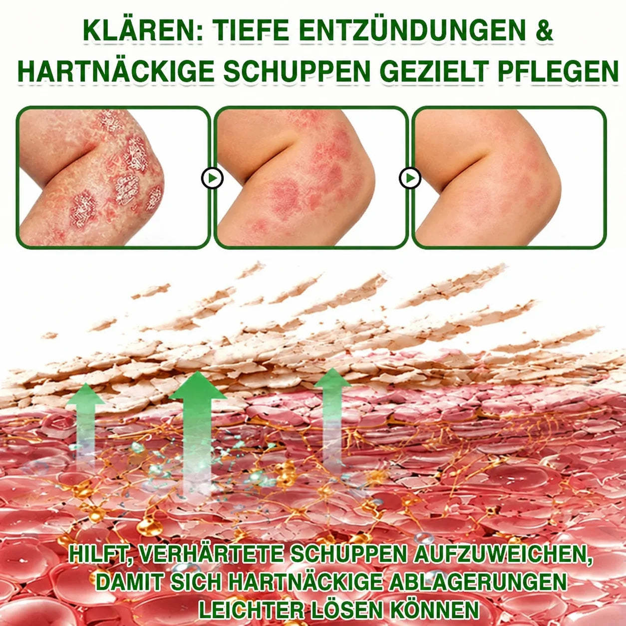 AQA DE Bild 07 – Gezielte Pflege