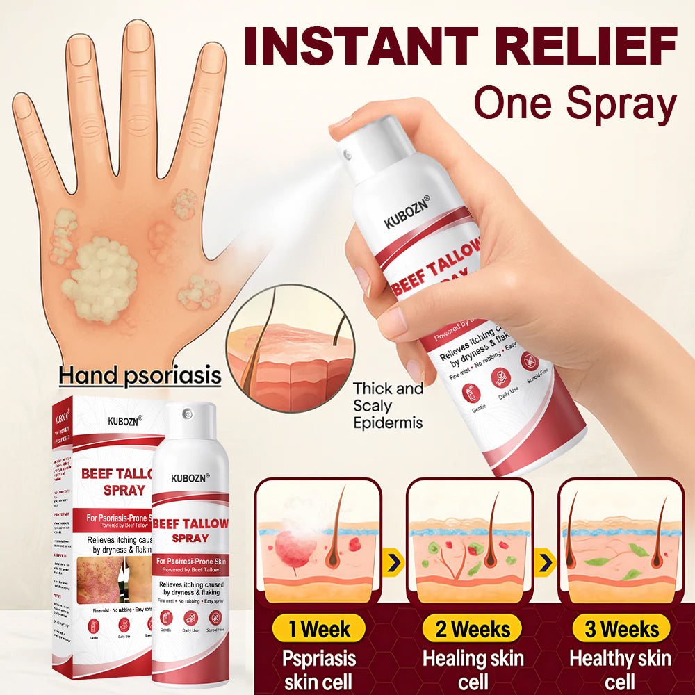 KUBOZN® Beef Tallow Spray for Itchy, Flaky Psoriasis Skin 1