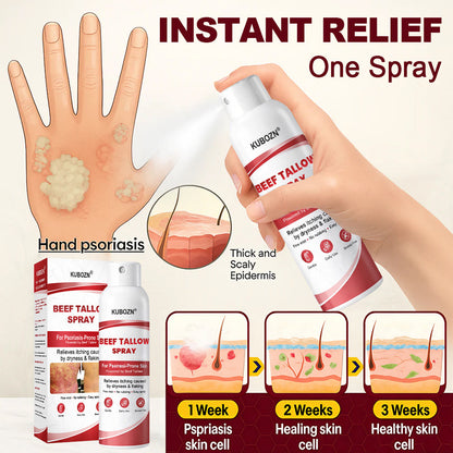 KUBOZN® Beef Tallow Spray for Itchy, Flaky Psoriasis Skin 1