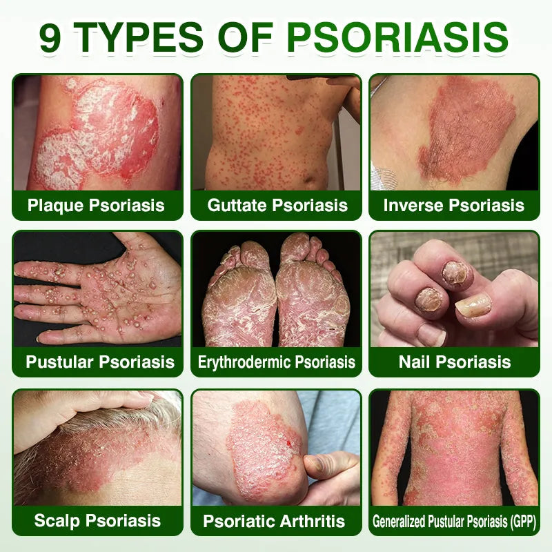 Visual guide to common dry and flaky-looking skin concerns