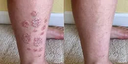 Customer-supplied lower-leg comparison photo
