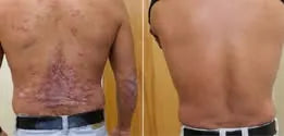 Customer-supplied back comparison photo