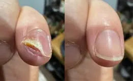 Customer-supplied nail comparison photo