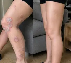 Customer-supplied leg comparison photo