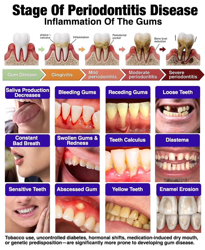 Illustrated stages and common signs of periodontal disease