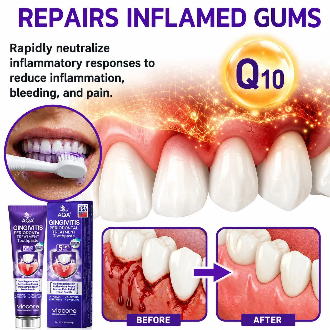 AQA VioCore toothpaste illustration for red and bleeding gums