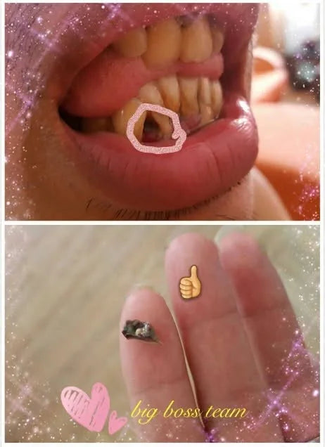 Shared close-up image connected with a gum-care routine