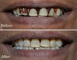 Shared before-and-after smile reference photo